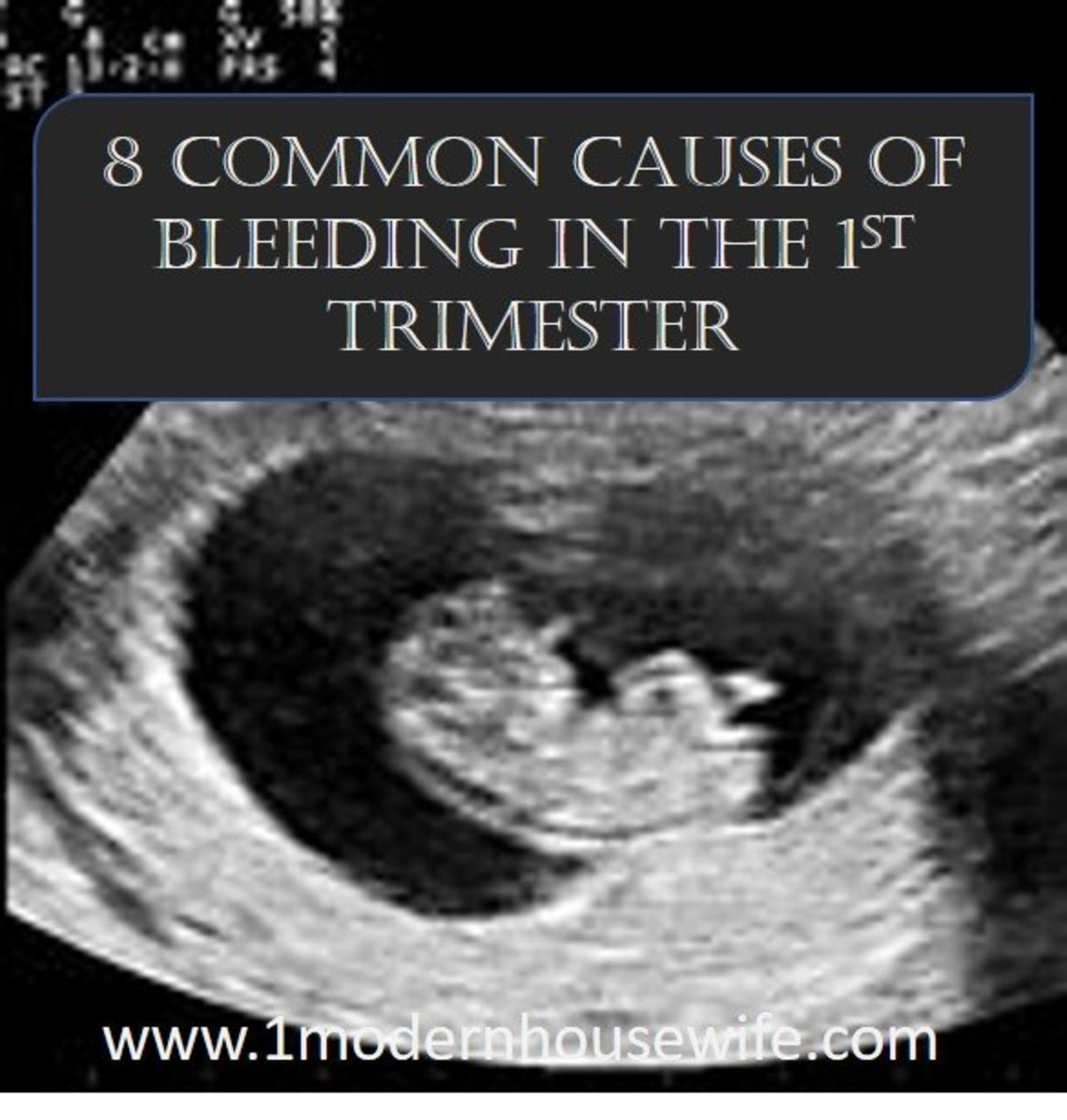 8 Common Causes for Bleeding in the First Trimester