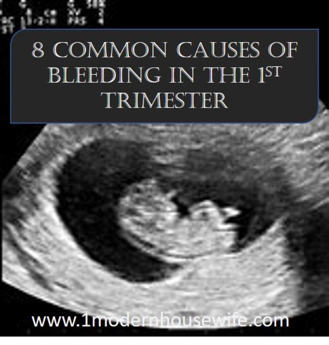 8 Common Causes For Bleeding In The First Trimester WeHaveKids