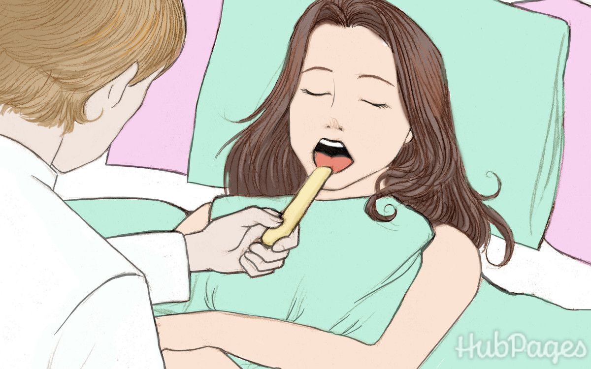 Can you really get a canker sore on your tonsils?