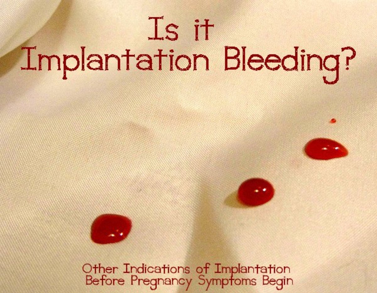 Signs Of Implantation Bleeding Carefully Plan