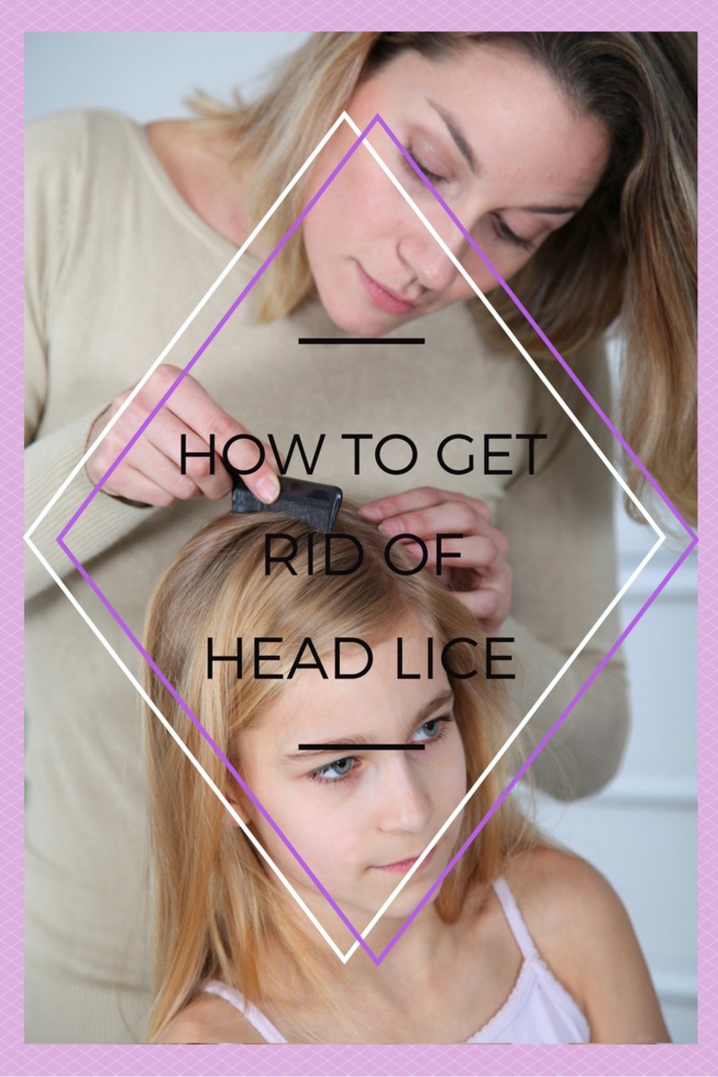 How to Get Rid of Head Lice (5+ Methods)