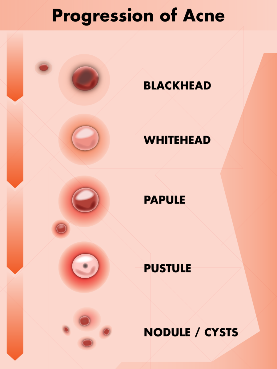 How To Tell The Difference Between Herpes And Pimples With Photos 