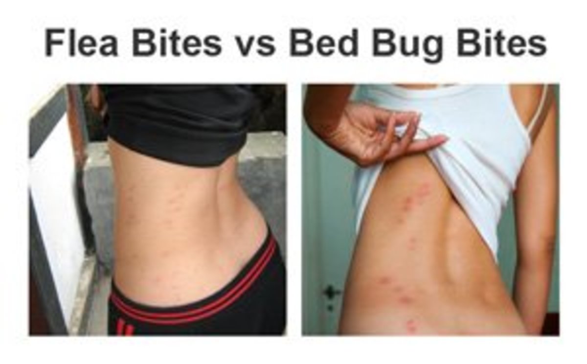 how-to-tell-between-fleas-and-bed-bugs-detection-prevention-and-treatment