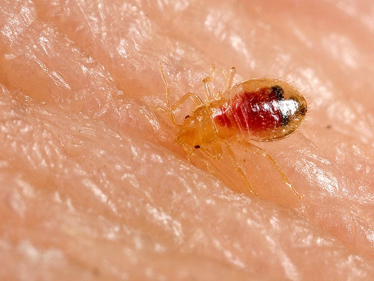 Bed bugs can upset your sleep and plague your body with annoying welts. This guide will help you identify if you have a bed bug infestation and help you figure out how to deal with it.