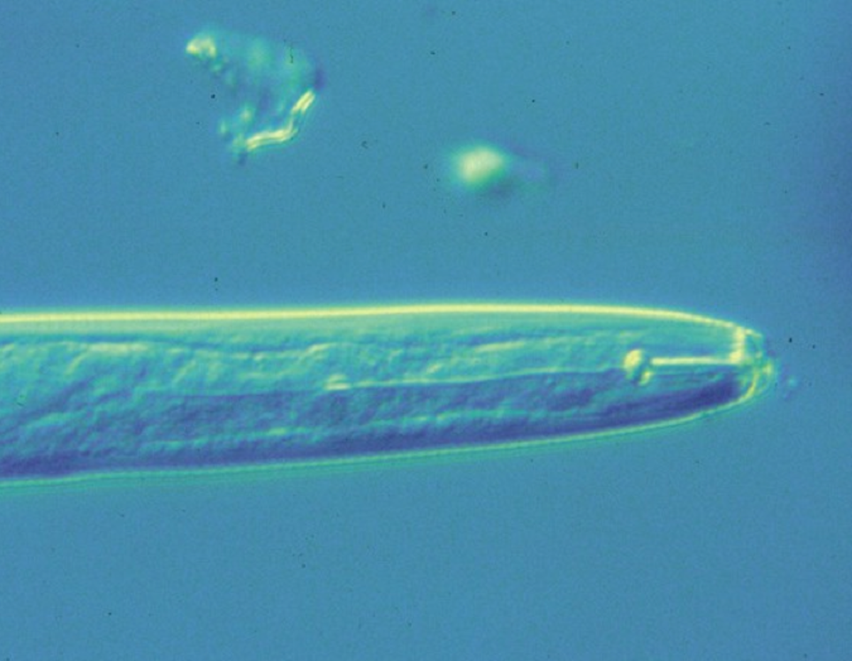 A micrograph of a lesion nematode showing the style mouthpart.