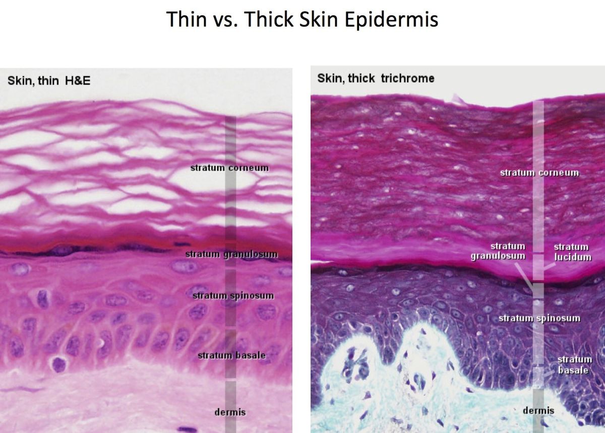 #thinskin  #epidermis 