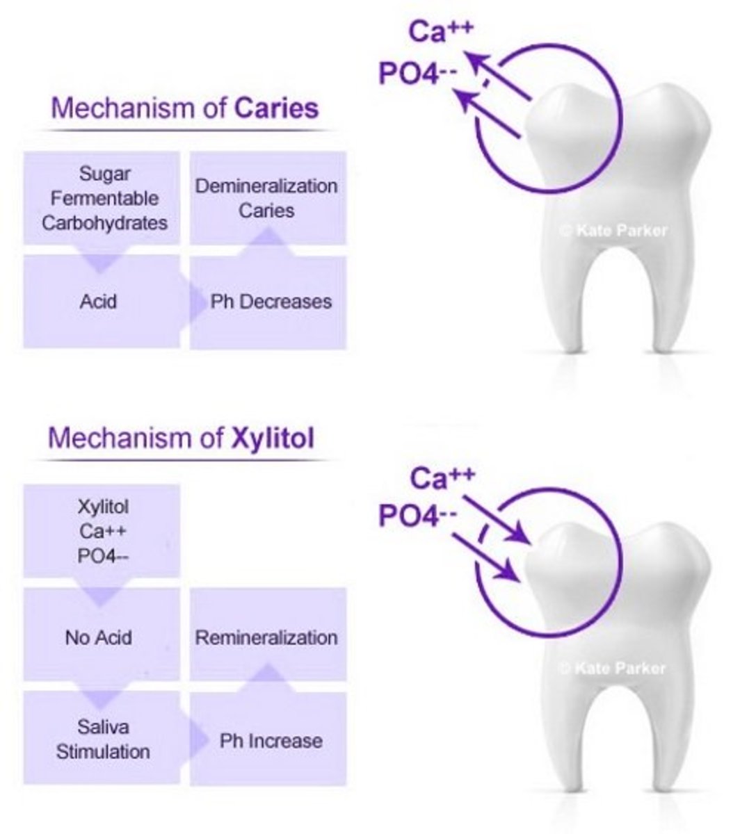Caries vs. Xylitol