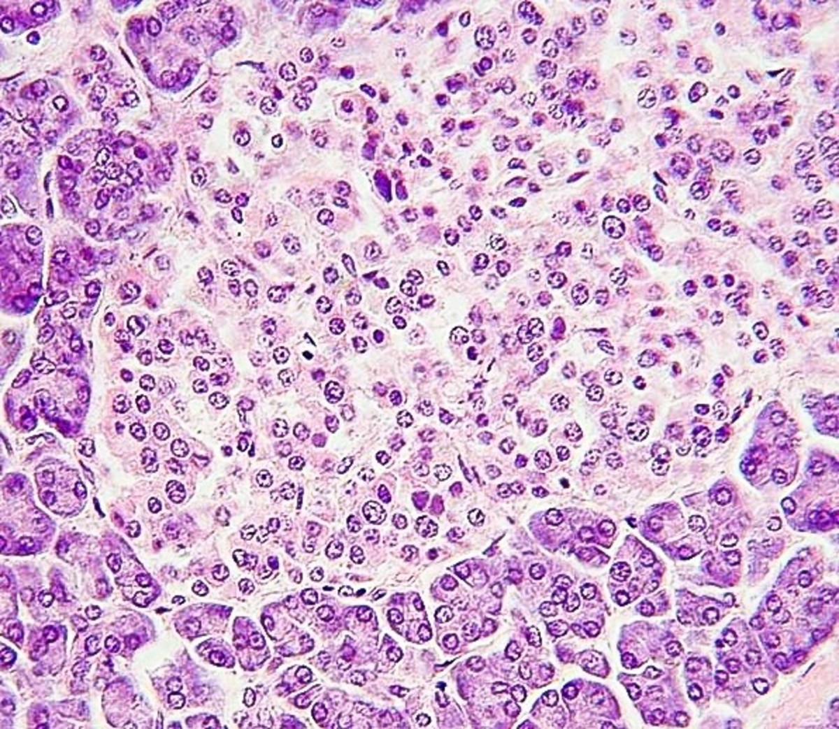 An islet of Langerhans or pancreatic islet (the paler area in this stained slide) makes both glucagon and insulin.