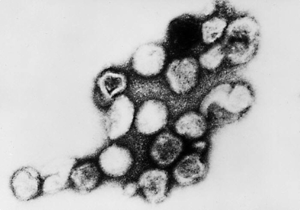 A transmission electron micrograph of the virus that causes rubella