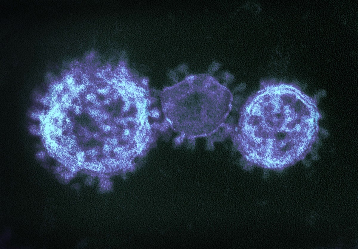 A colourized transmission electron micrograph of three MERS virions