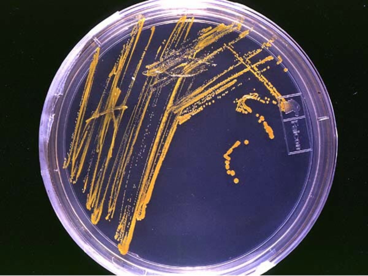 Microbes growing on agar in a Petri dish