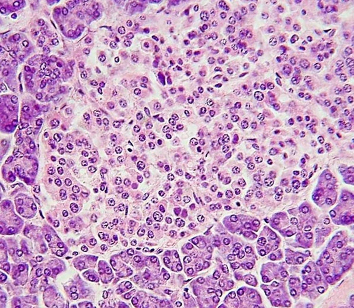 The pancreatic islet is in the middle of this stained slide. The acini surround the islet.