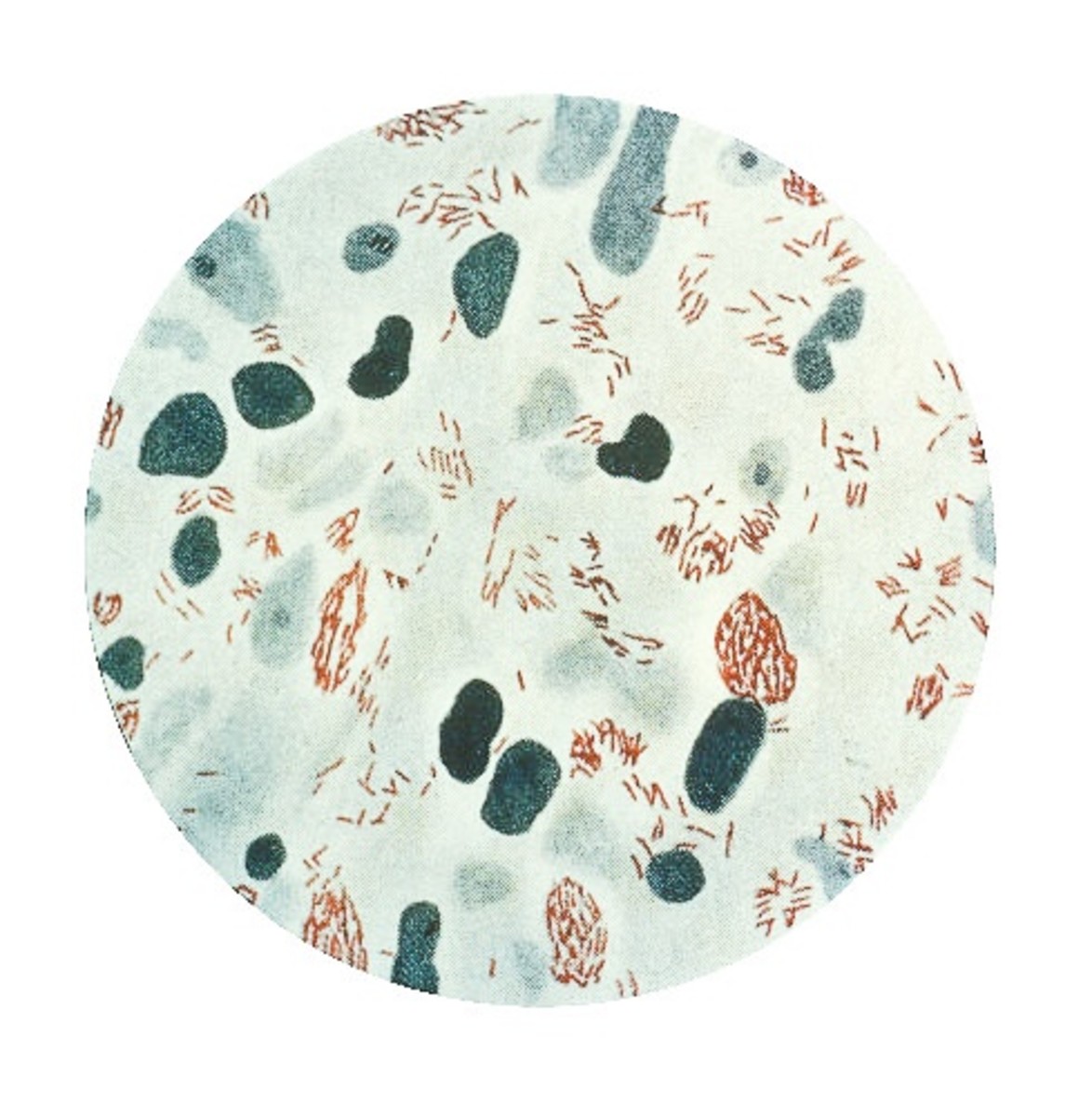 Mycobacterium leprae is the main cause of leprosy. The bacterium is stained red in this photo.