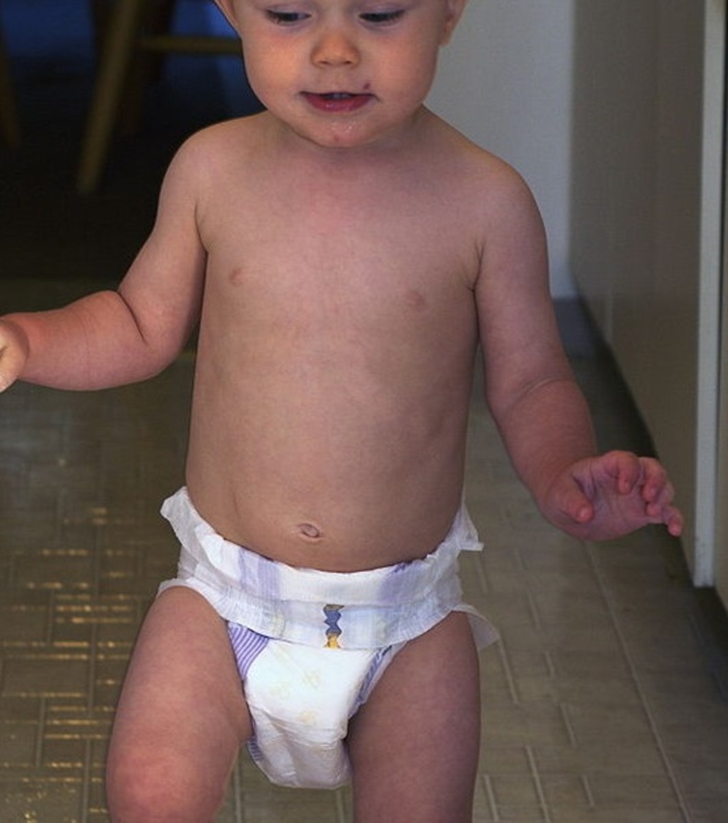 To help avoid diaper rash, diapers should be slightly loose fitting and changed before they're "full" with urine, even if the manufacturer describes them as super- or extra-absorbent