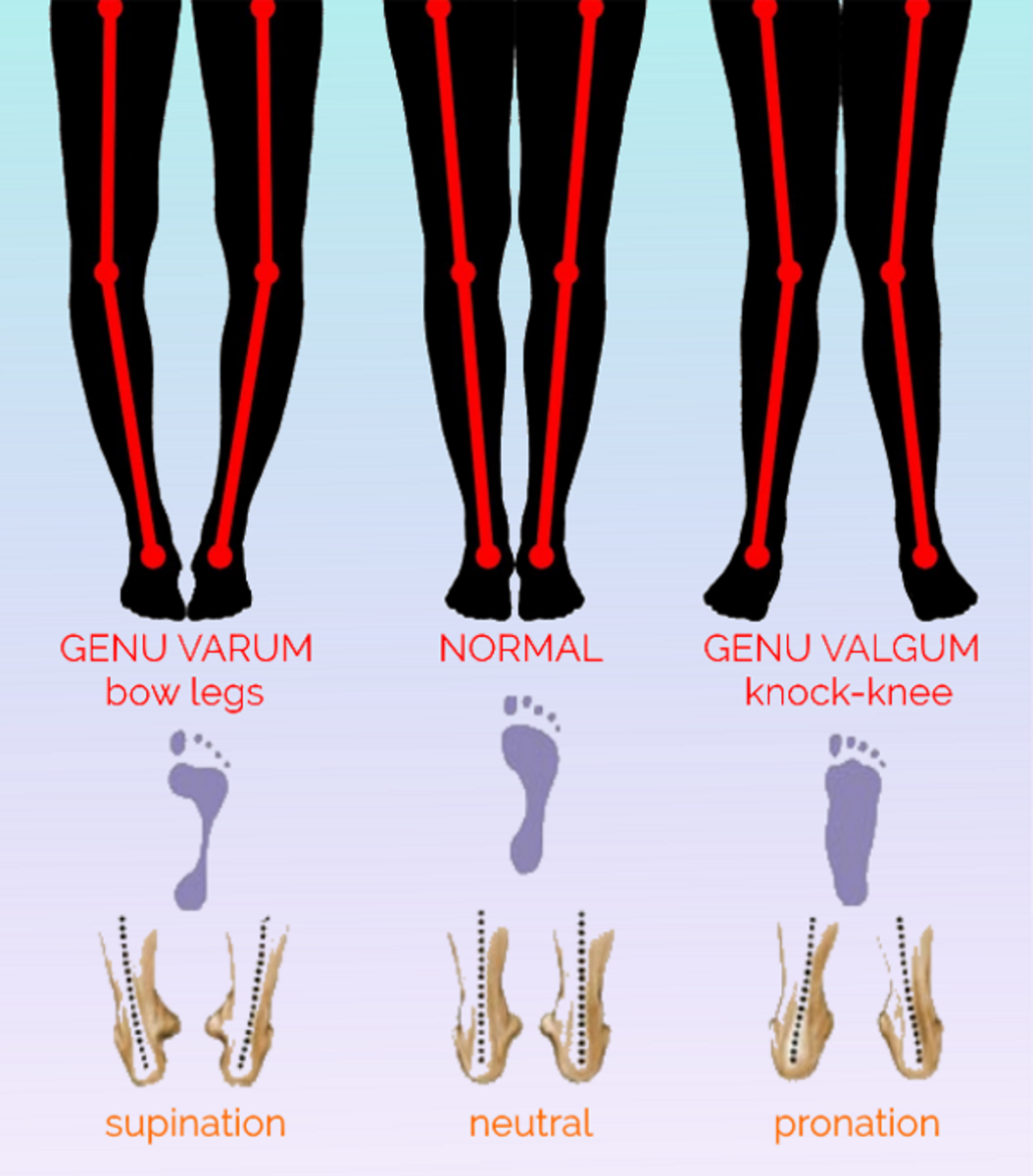 For best performance in standing and walking, starting at the base, all the joints in the leg should be vertically aligned as in the center image.