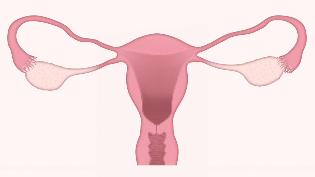 cervical-cancer-affects-poorer-women