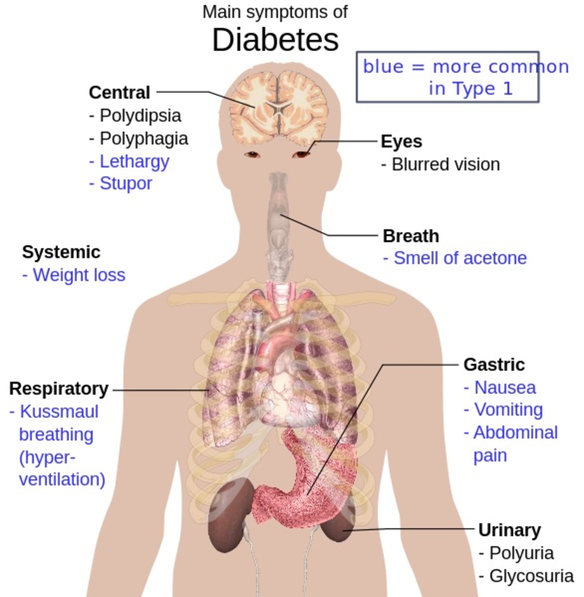 Main symptoms of diabetes