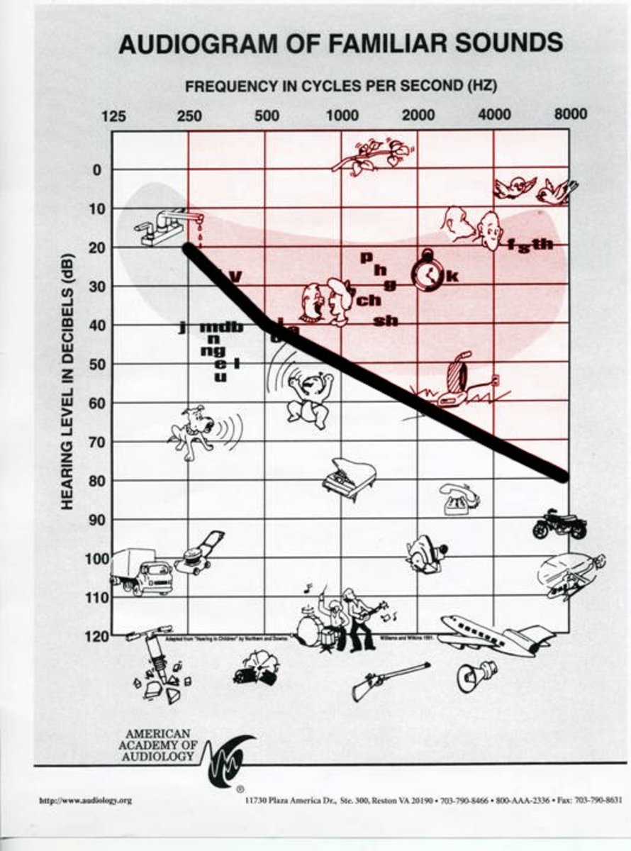 An example of a person's hearing loss charted on an audiogram. This individual cannot hear the sounds highlighted in red.