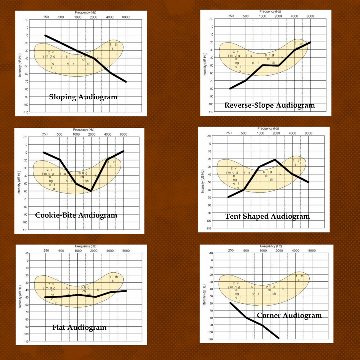 The various types of audiograms (click to enlarge).