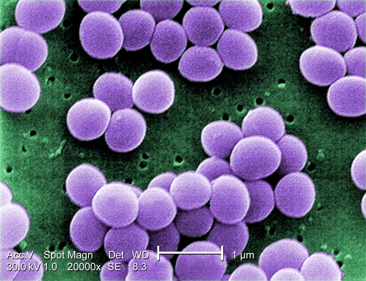 Staphylococcus aureus is a common cause of boils. The bacterial cells in this photo have been magnified 20,000 times. False colour has been added to the photo.