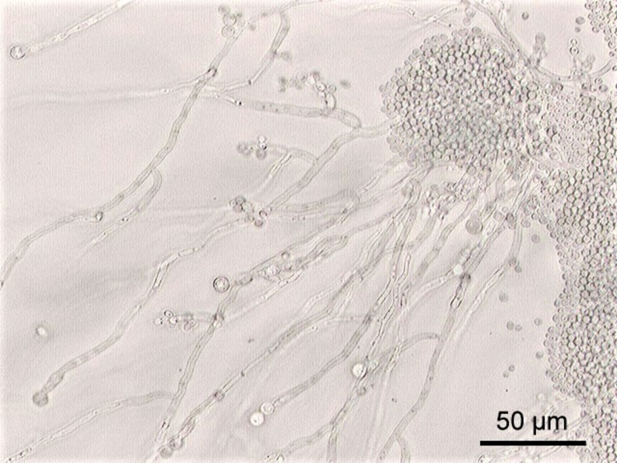 Candida albicans cells and filaments 