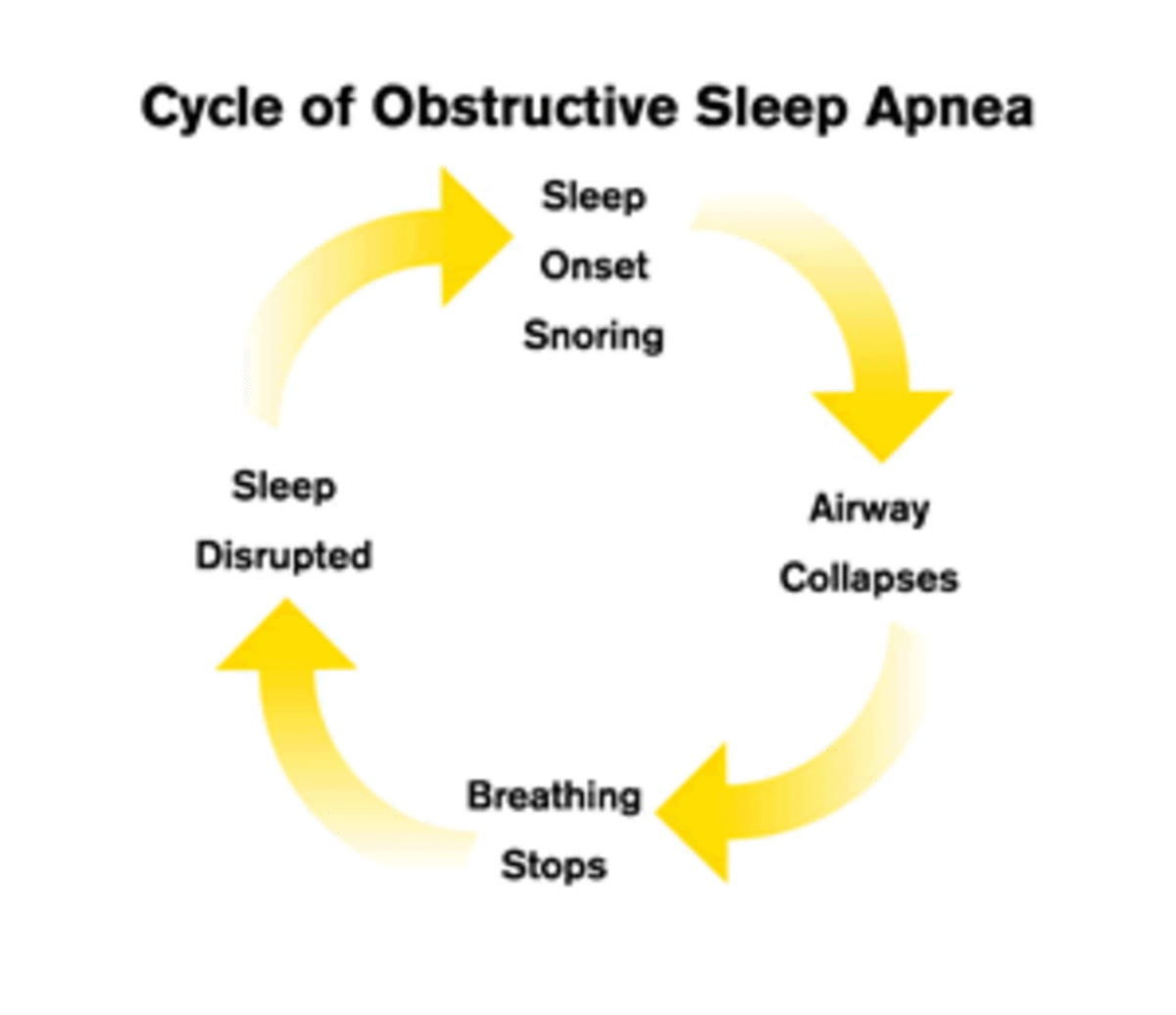The sleep cycle of OSA shows how your sleep is interrupted. Your airway collapses, causing your breathing to stop, which disrupts your sleep.
