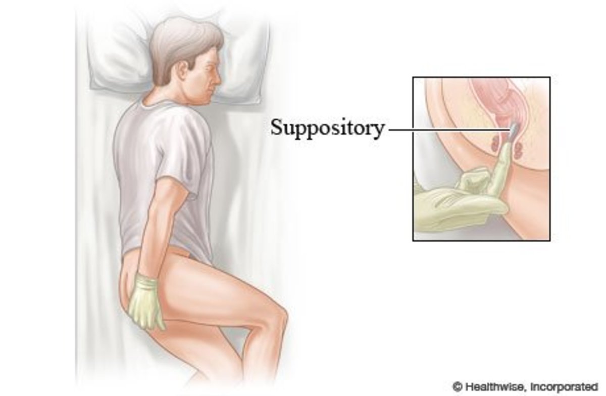 Proper position for suppository insertion.