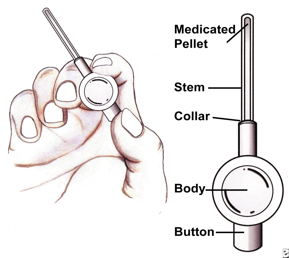 Medicated Urethral System for Erections (MUSE) applicator 