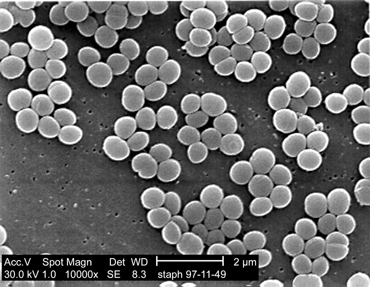 Staphylococcus aureus, a common bacterium on human skin