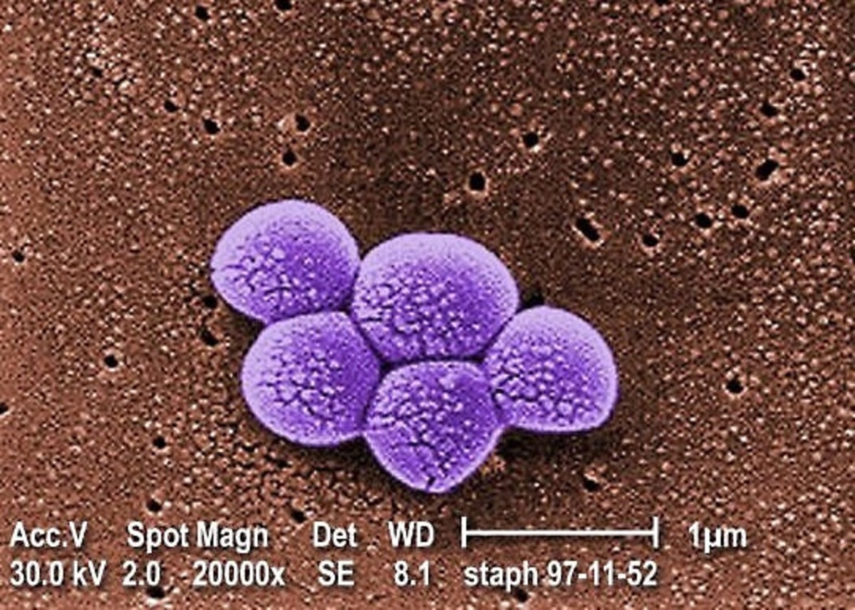 A colorized view of the MRSA bacterium