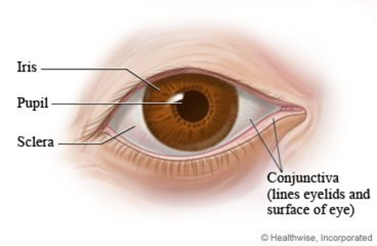 causes-of-a-red-spot-on-eye