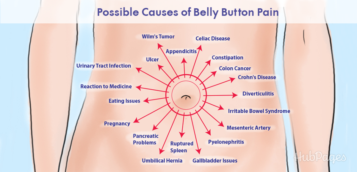 Possible causes of belly button pain.