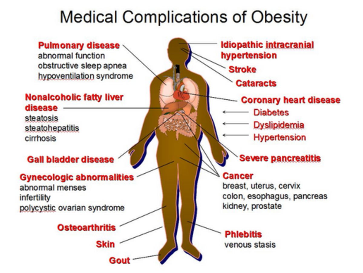 Medical effects of obesity