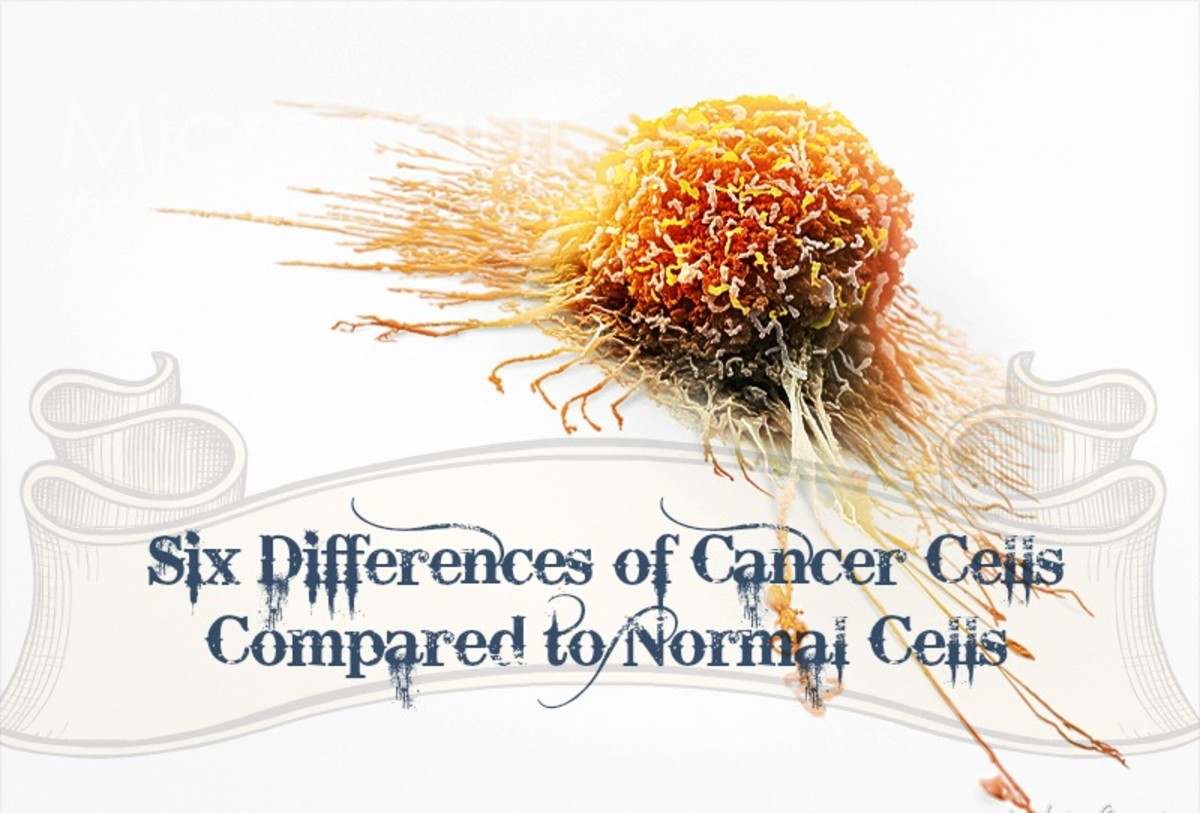6 Differences Between Cancer Cells and Normal Cells