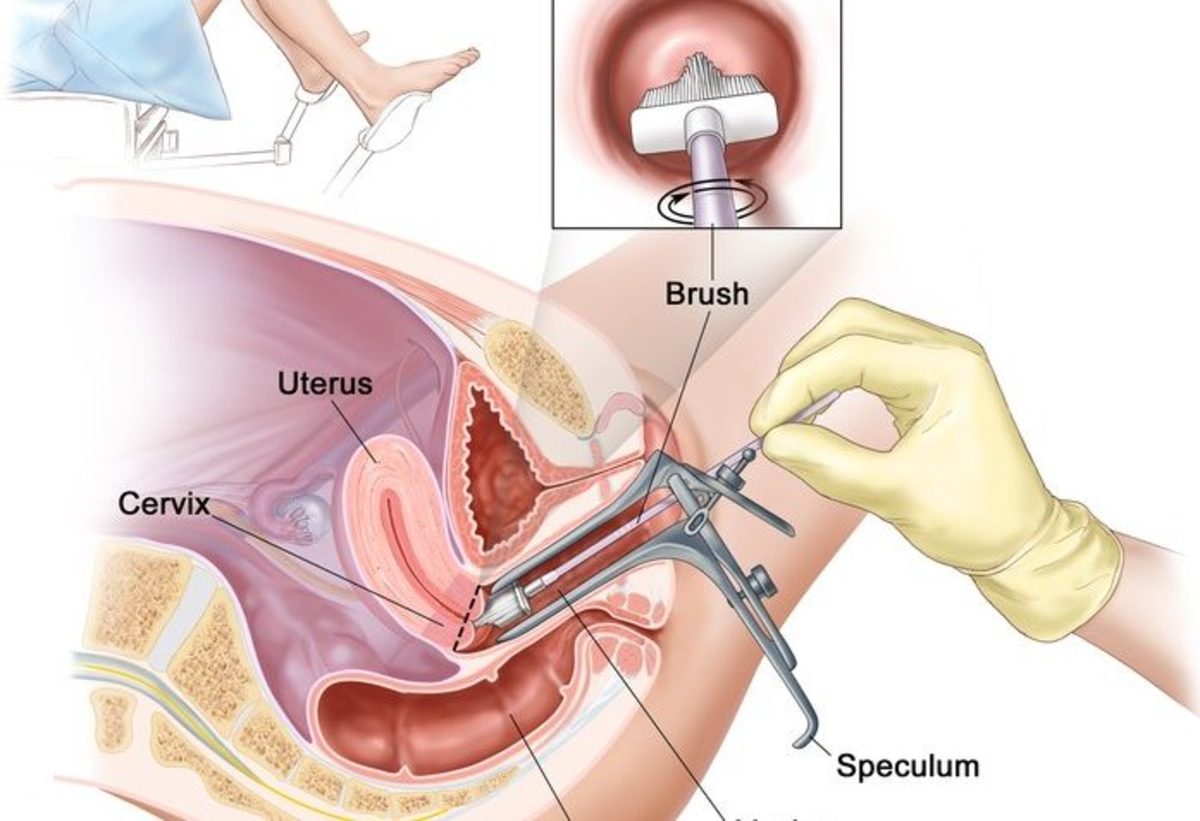The speculum is used to keep the vagina open and the brush is used to scrape off cells from the cervix.