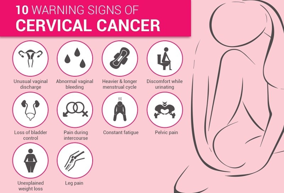 You do not have to experience these symptoms in order to get a Pap test done. Periodic screening can help prevent cervical cancer.