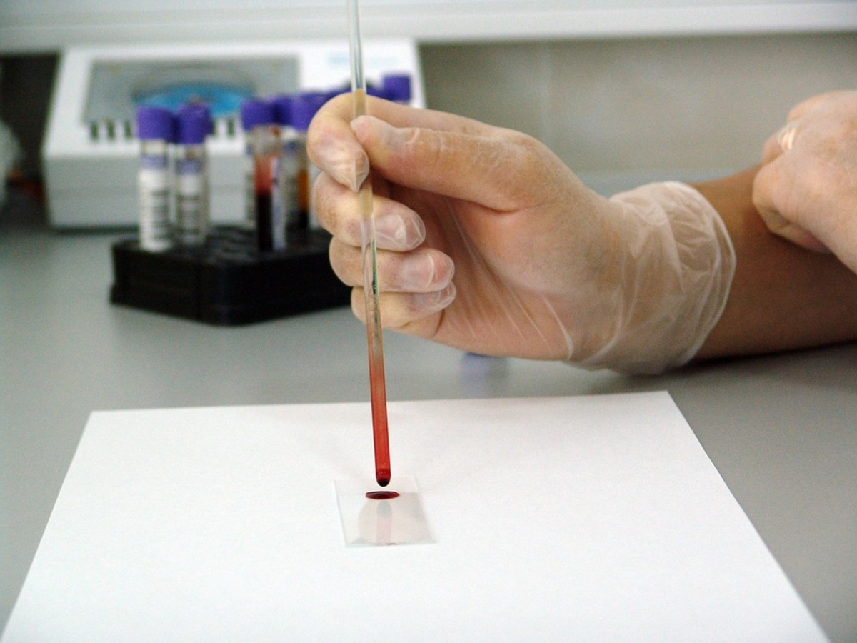 Tissue Test: Biopsy Fundamentals and How to Prepare for One