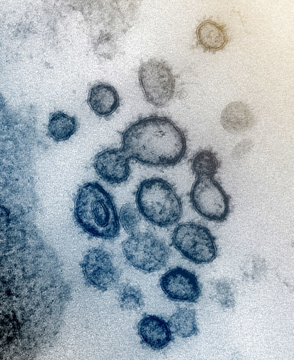 Up-close image of the Coronavirus.