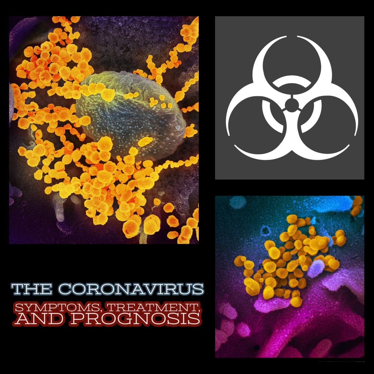 The Coronavirus: Symptoms, Treatment, and Prognosis