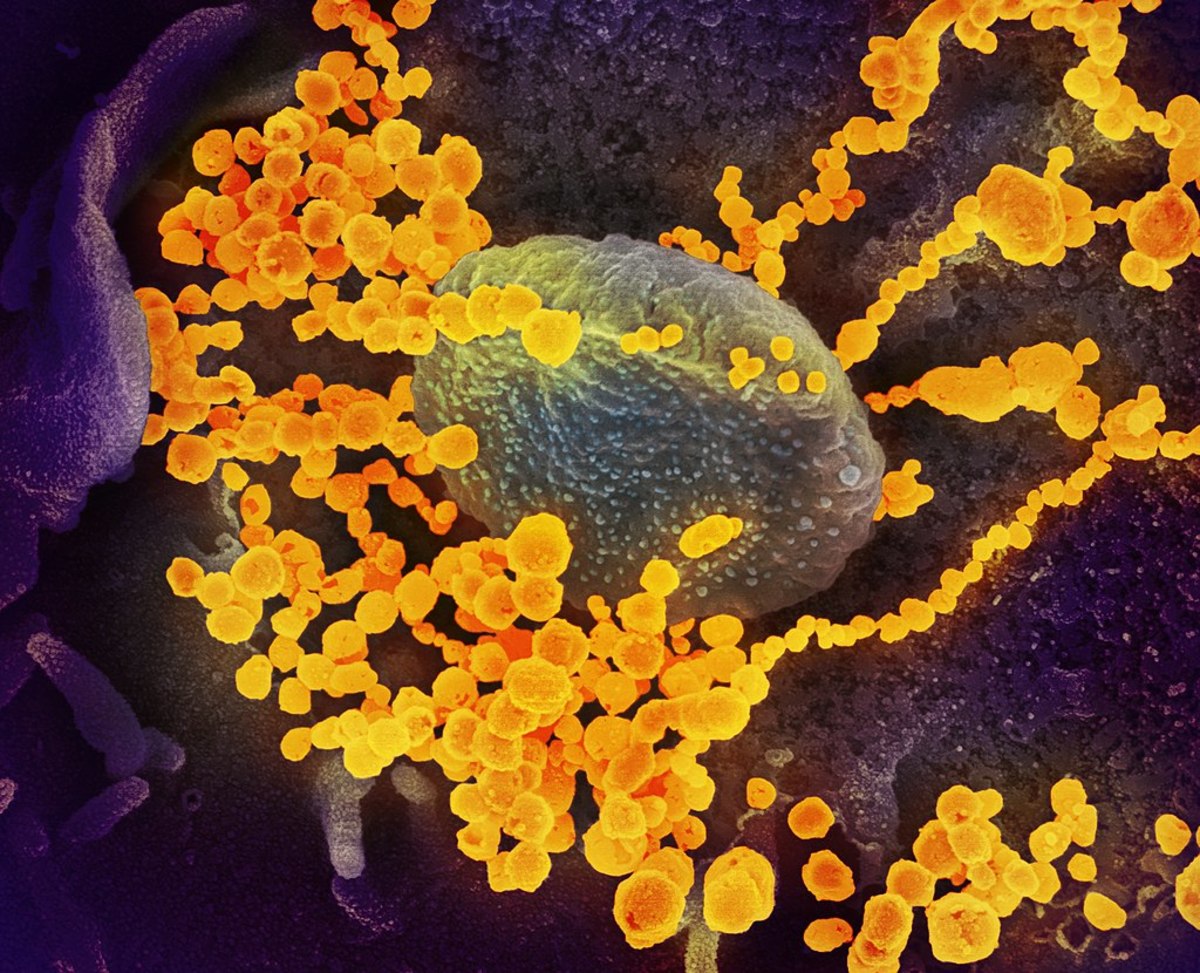 Coronavirus within human cell.