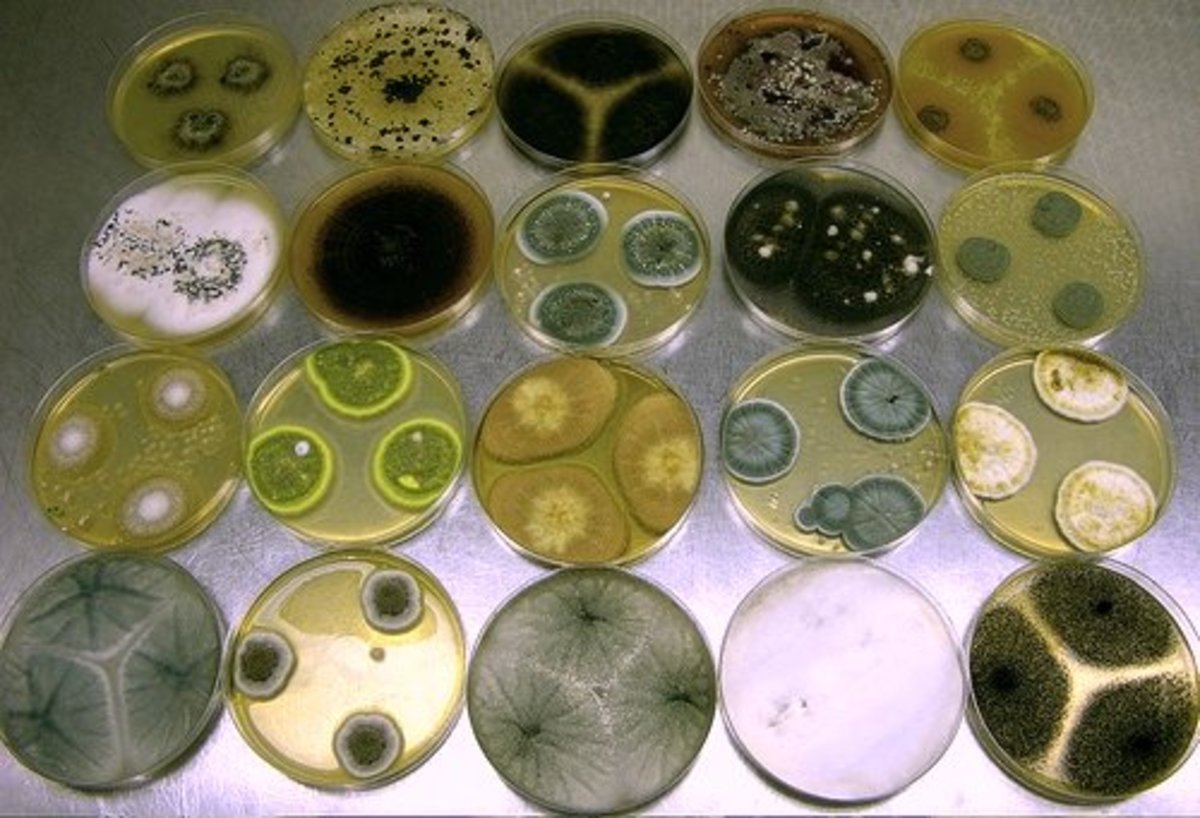 In the image you can see various species of Aspergillus mold.
