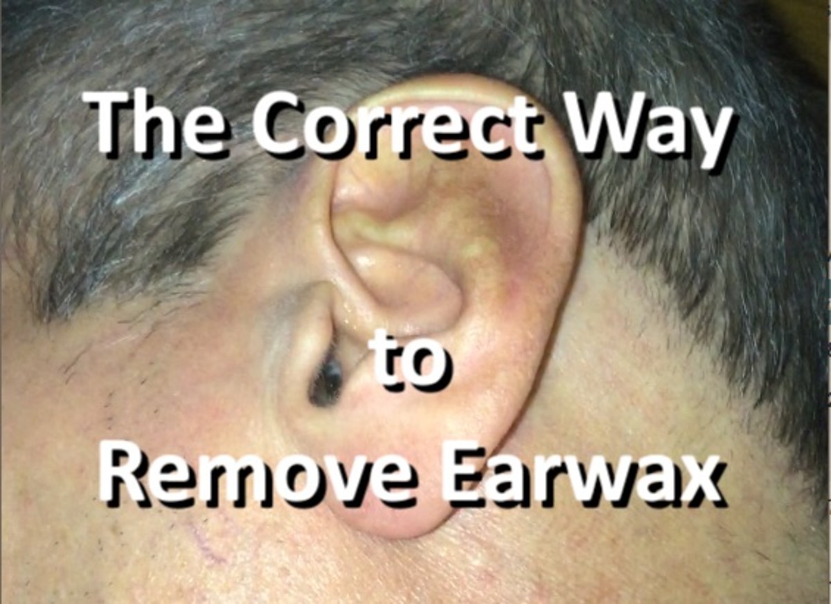 impacted ear wax removal toddler