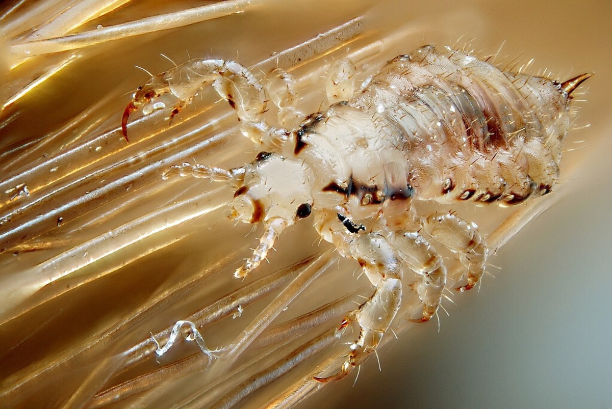 A male head louse