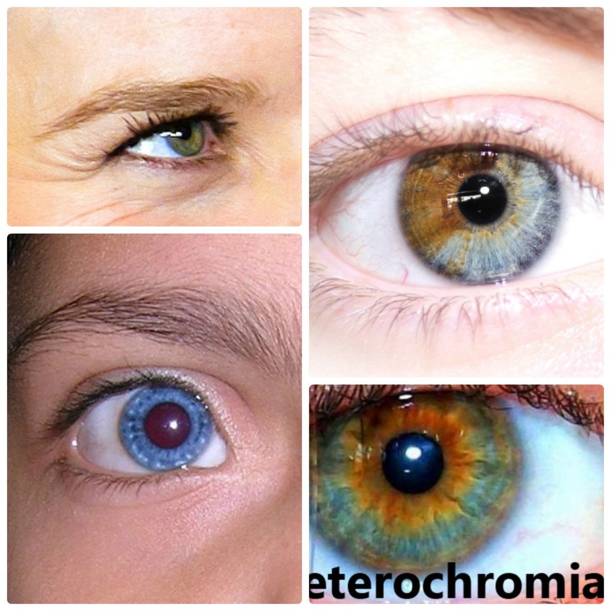 Heterochromia Iridum People With Two Different Colored Eyes Owlcation