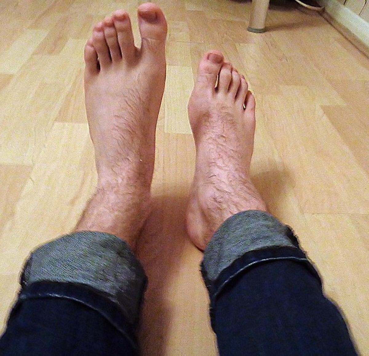The Difficulties of Living With Foot Drop and How You May Treat It