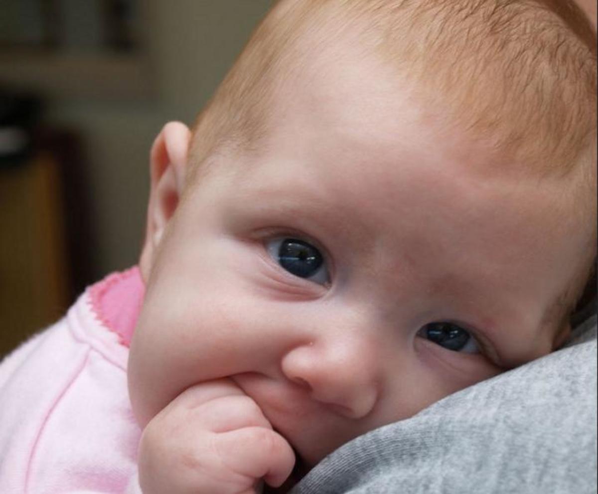 How does eczema affect babies?