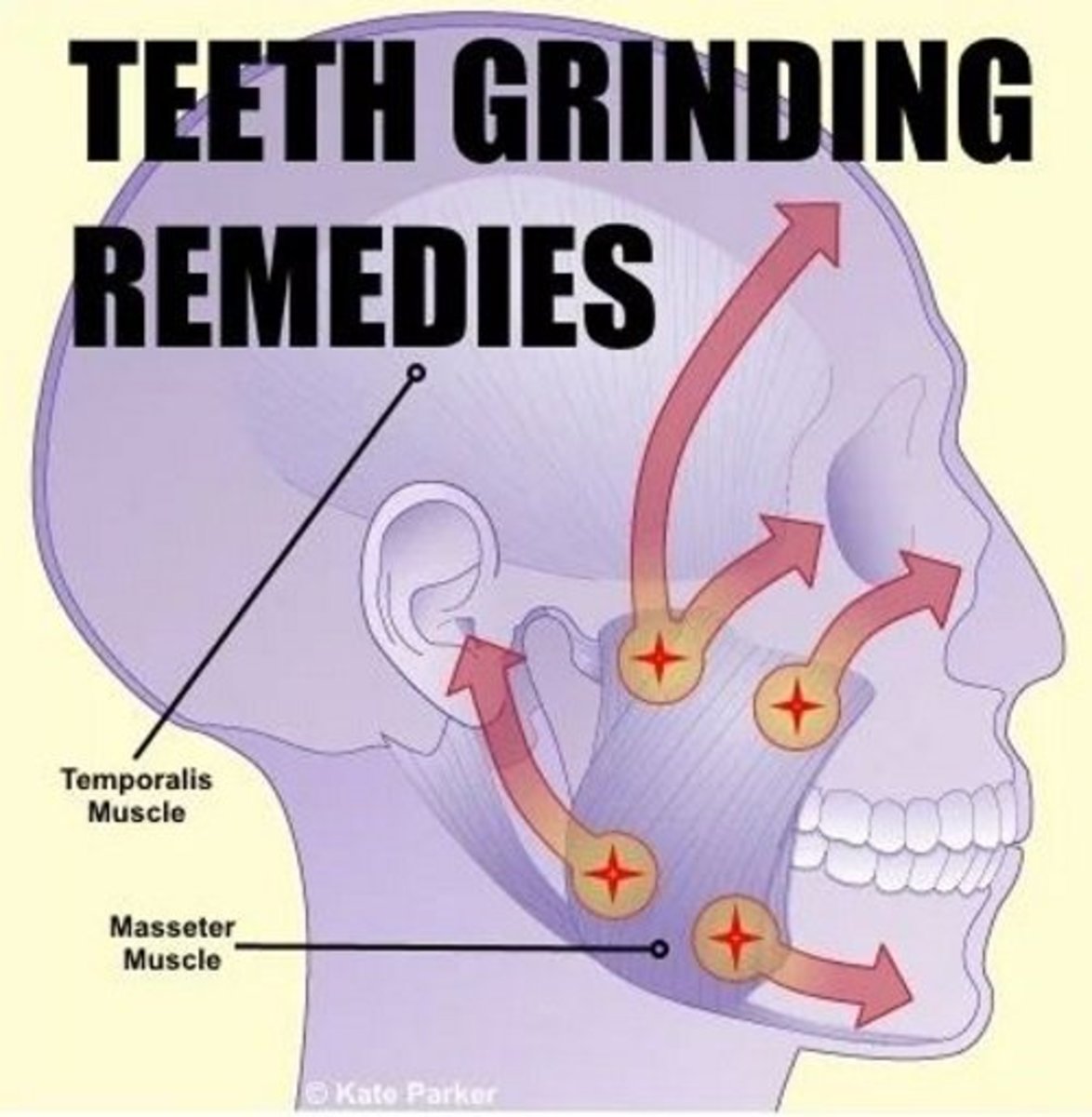 How to Stop Grinding Your Teeth