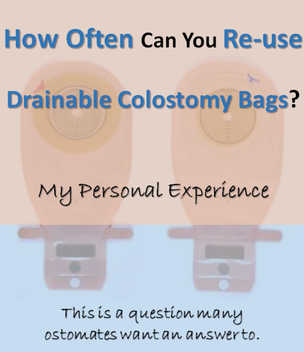 How Often Can You Reuse Drainable Colostomy Pouches? My Personal ...