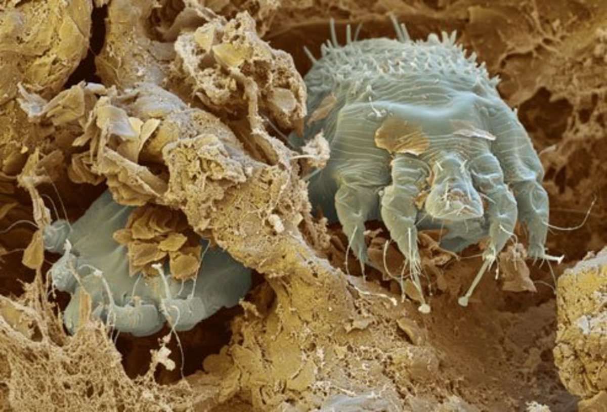 This microscopic mite is responsible for transmitting the highly contagious parasitic infection, scabies.