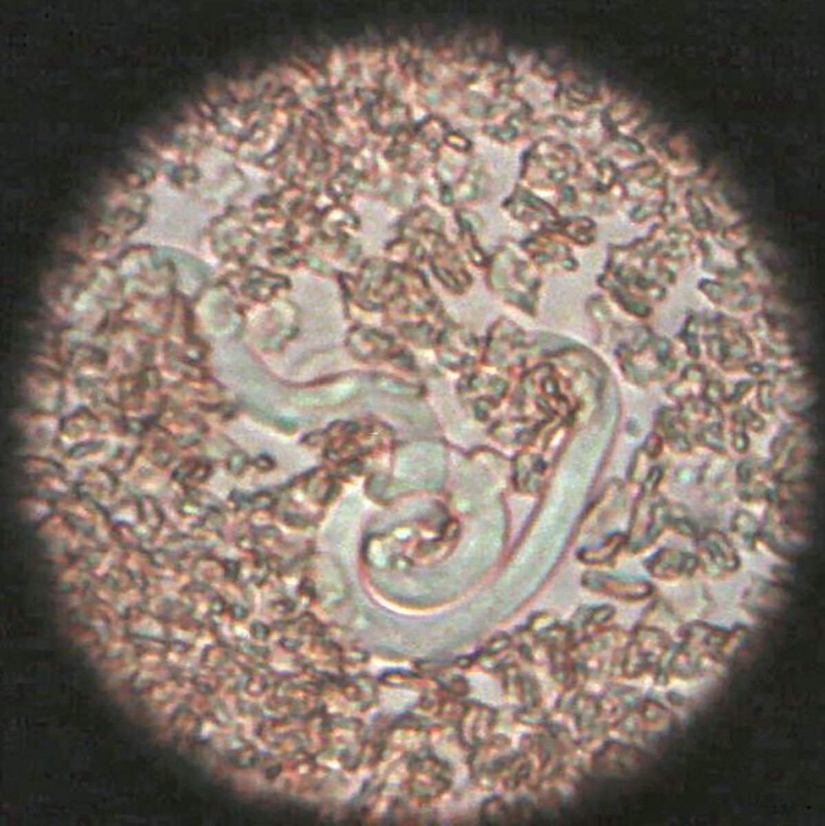 Dirofilaria immitis, or heartworm, under a microscope